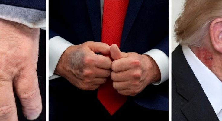 bruised hands and profile view of a man in a suit, intense focus